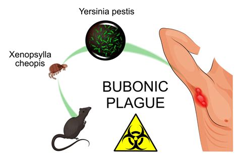 Pathogen Of The Month Yersinia Pestis Gideon Global Infectious