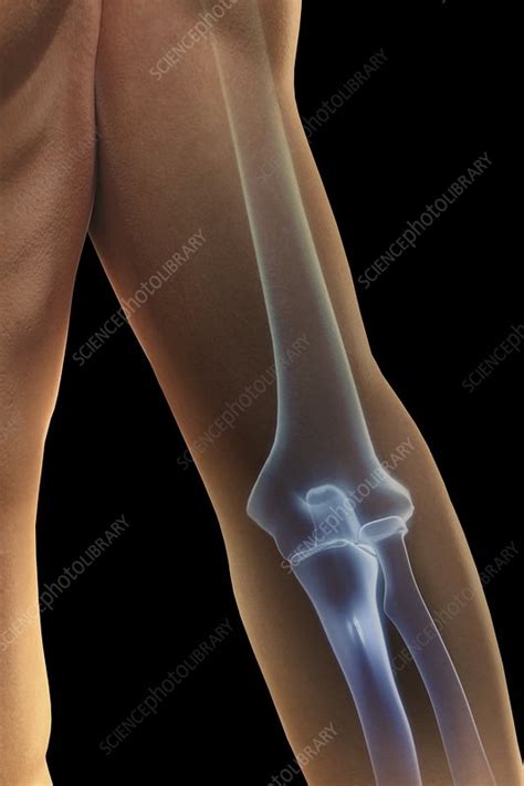 Bones of the Elbow, artwork - Stock Image - C020/0793 - Science Photo