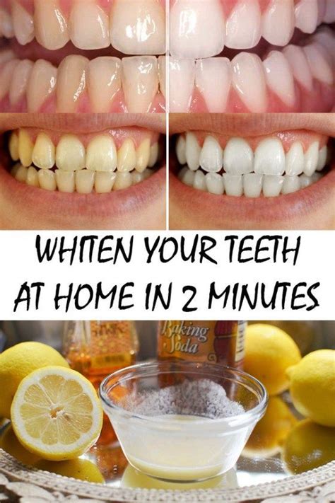 Whiten Your Teeth At Home In 2 Minutes Beauty Teeth Whitening Diy