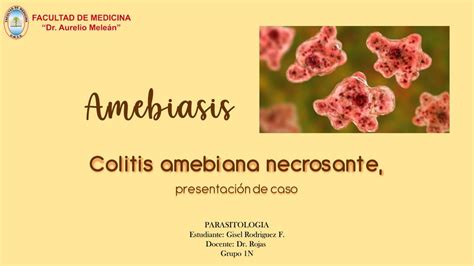 Amebiasis Udocz