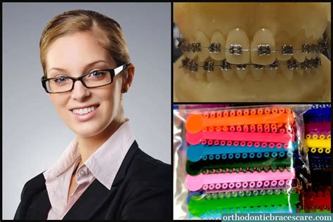 Orthodontic Ligature Ties Braces Color Bands 1040 Pcs Annhua Dental Orthodontic Elastomeric O