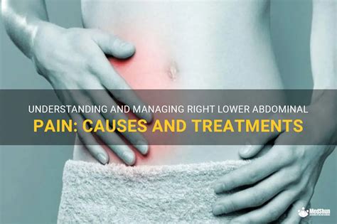 Understanding And Managing Right Lower Abdominal Pain Causes And Treatments Medshun