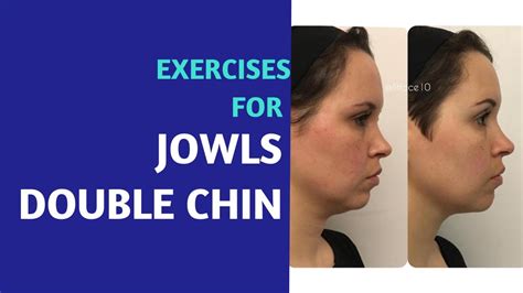 Double Chin Jowls Exercises Before And After Youtube