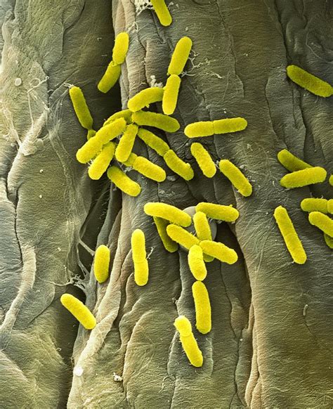 E Coli Bacteria Sem Photograph By Science Photo Library Fine Art