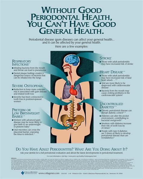 How Periodontal Disease Affects Your Health Oakland Berkeley Dentist Sharon L Albright D D S