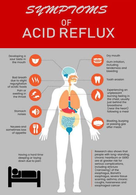 Acid Reflux Causes Picture Symptoms And Treatment Pelajaran