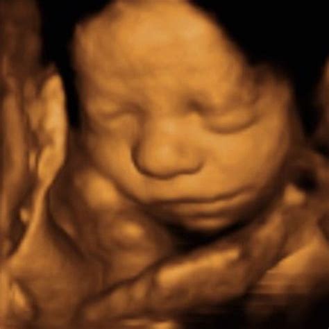 3d 4d Ultrasound Scanning At Scansanctuary Pregnancy And Prenatal
