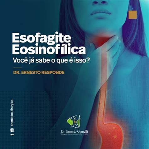 Esofagite eosinofílica Você sabe o que é isso Dr Ernesto Comelli