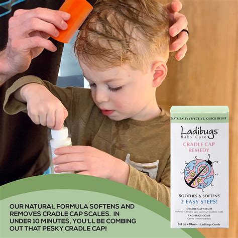 Ladibugs Cradle Cap Remedy Kit 3oz Includes Cradle Cap Serum And Fine