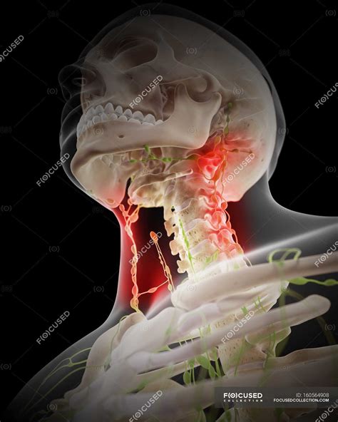 Painful Human Lymph Nodes — Skull Neck Stock Photo 160564908