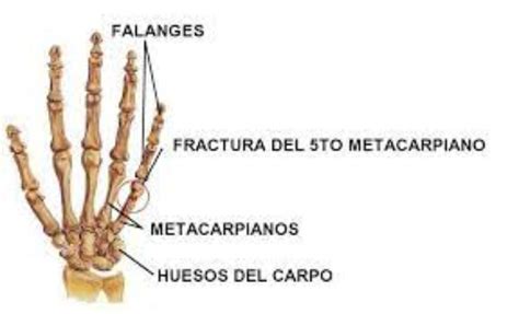 Huesos Del Metacarpo Anatomía Y Función