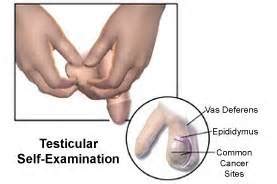 A lump or enlargement in either testicle. Causes of Testicular Cancer and What Does It Feel Like