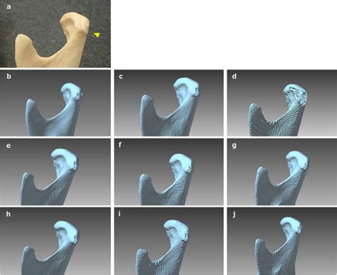 dicom segmentation and stl creation for 3d printing a process and software package comparison