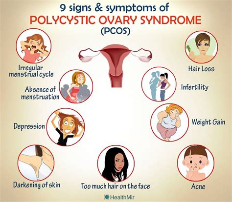Pcos Polycystic Ovary Syndrome Womens Health Healthy Living