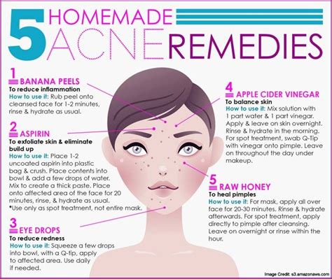 9 Natural And Vegan Ways To A Glowing And Acne Free Skin Acne Remedies