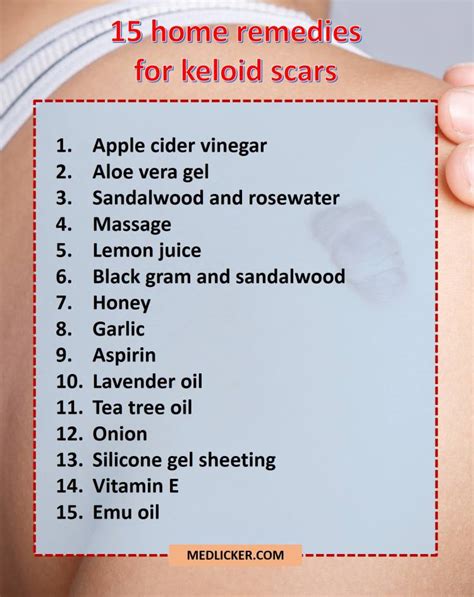 Awesome See How These 17 Remedies May Help You Get Rid Of Keloid Scars