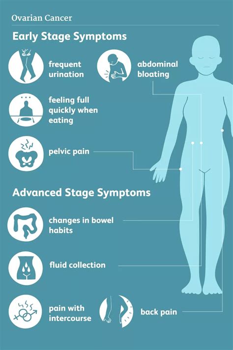 Ovarian cancer symptoms are similar to many common conditions, so they can be hard to detect. Women who use low-dose aspirin had a 23% lower risk of ...