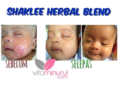 Herbal blend cream shaklee fungsi untuk satu keluarga january (6) 2015 (102) december (6) november (8) october (15) september (27) august (21) july (2) Himpunan Testimoni Cream Herbal Blend Shaklee - KAK WAWA ...