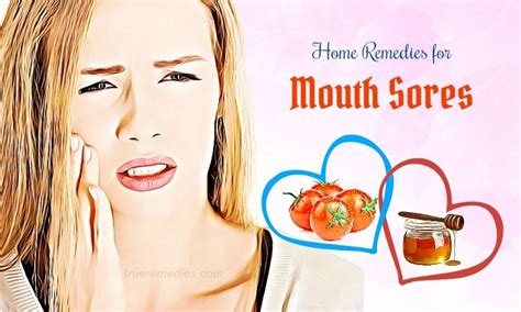 14 Home Remedies For Mouth Sores Reduction On Tongue And Lips