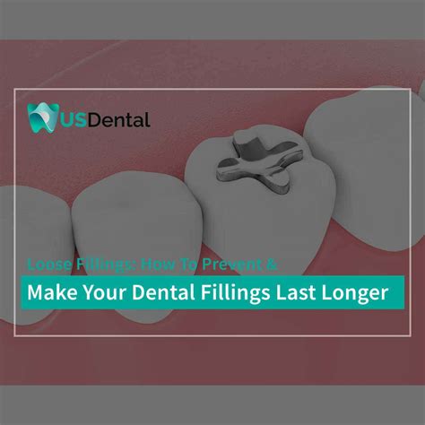 Loose Fillings How To Make Your Dental Fillings Last Longer