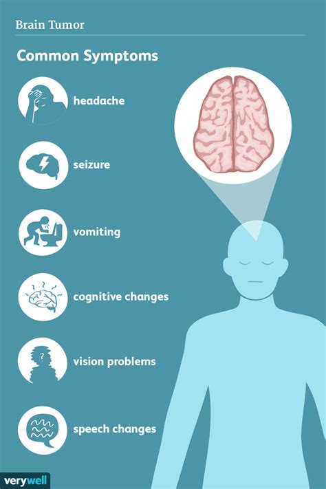 Brain Tumor Symptoms Headaches Seizures Dizziness And More