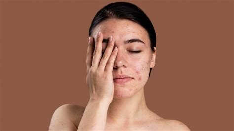 Most Common Skin Disorders Symptoms Causes And Treatments