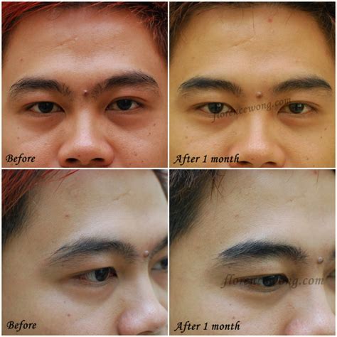 Elegant 3d Brow Embroidery Before And After Florence Wong