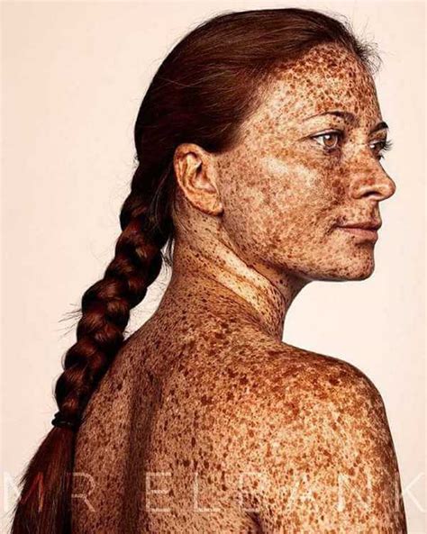Amazing Portraits That Prove Freckles Are Beautiful