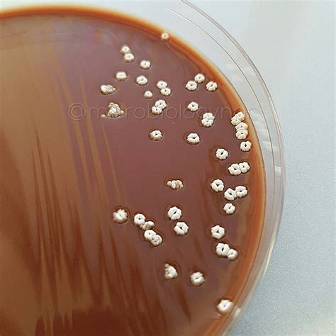 Nocardia Brasiliensis Here Seen On Chocolateagar 4 Days Old