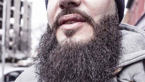 Best Method To Prevent And Treat Beard Acne Beard And Acne