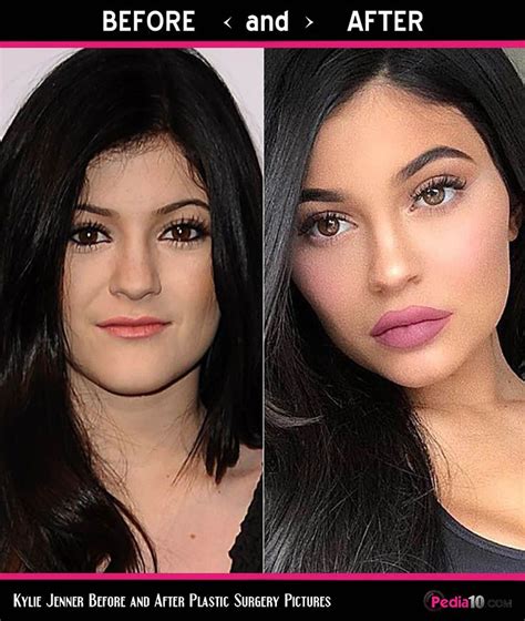 Do You Still Remember The Old Kylie Jenner Well These Kylie Jenner