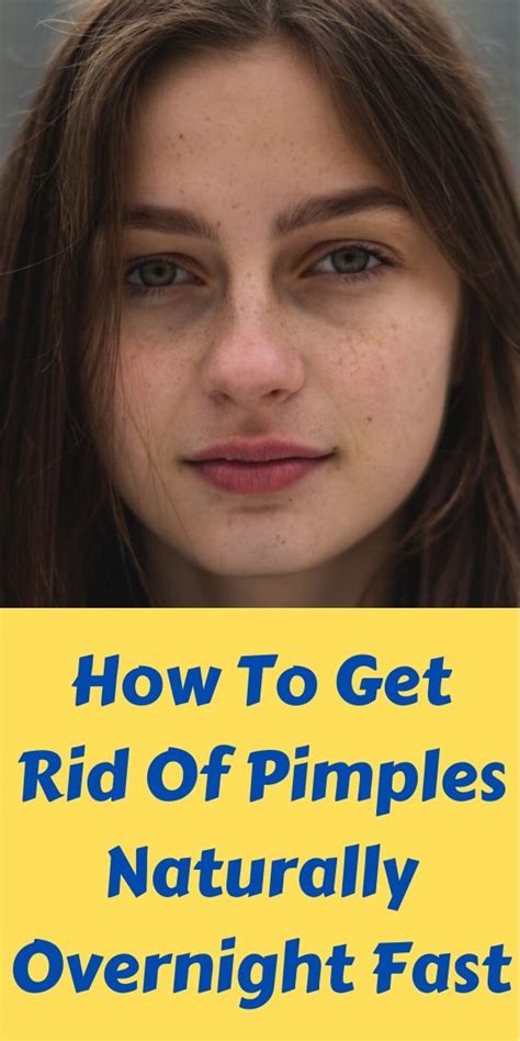 How To Get Rid Of Pimples Naturally Overnight Fast ~ SKINCARE
