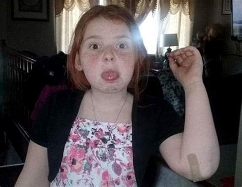 Girl 12 Scalped By Fairground Ride Says My Scars Will Never Define