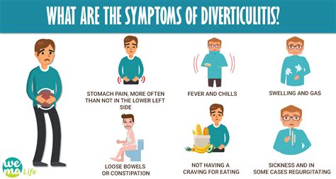 Diverticulitis Symptoms And Treatment