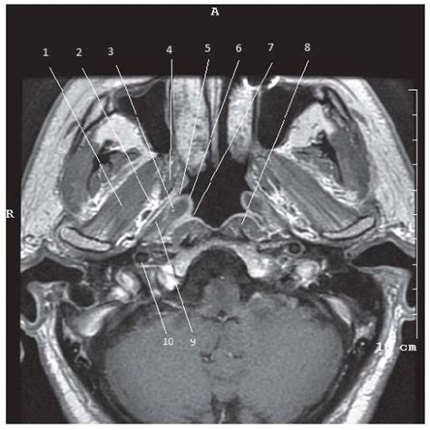 Was your doctor saying that it would be difficult to get an mri through your insurance? Radiologic Evaluation of the Head and Neck Cancer Patient ...