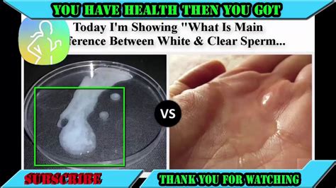 Sperm Cell Difference Of White And Clear Sperm YouTube
