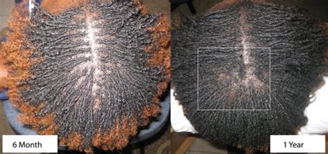 Finding the best hairstyles for thinning hair can be a challenge. Kreyola's Journeys: Thinning Roots - Hence Thinning Locks