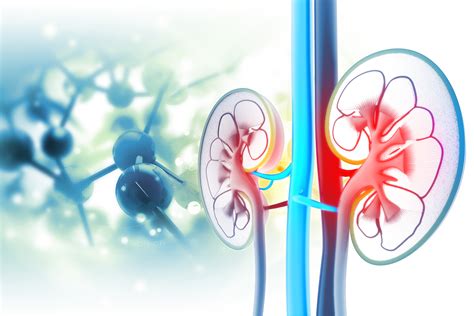Kidney Disease Causes National Kidney Foundation