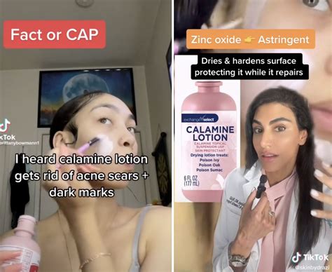 Calamine Lotion As Makeup Primer Dermatologists Respond To Trend