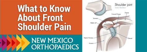 What To Know About Front Shoulder Pain New Mexico Orthopaedic Associates