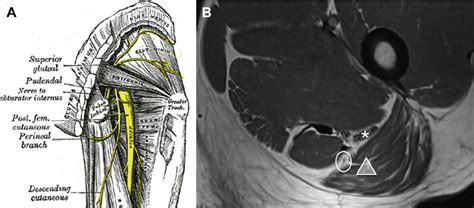 Femoral Nerve Map