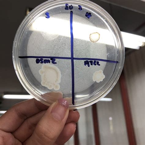 Bacillus Cereus On Agar Plate