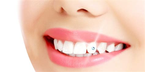 Tooth Jewellery Dr Pauls Dental Health Care Bangalore