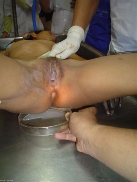 Autopsy Of An Indonesian Girl Motherless Com Daftsex Hd