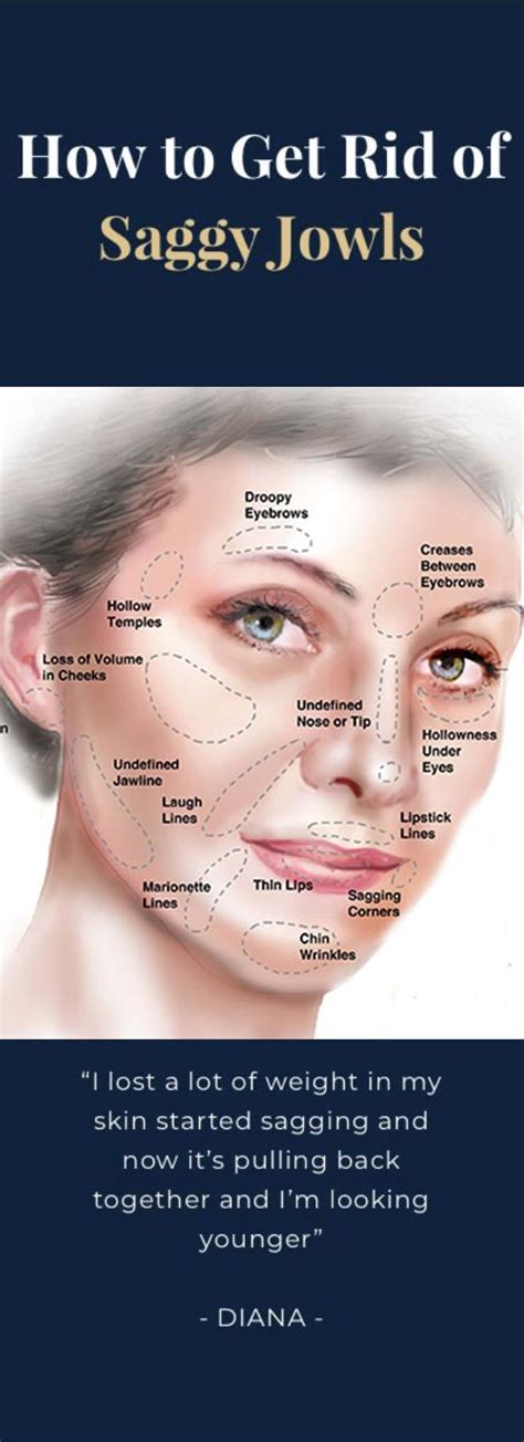 How To Reduce Saggy Jowls Diy Beauty Face Beauty Face Chin Wrinkles