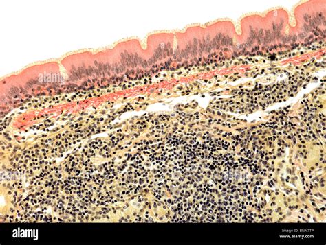 Trachea Micrograph Hi Res Stock Photography And Images Alamy