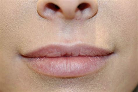 Semi Permanent Makeup Lips Before And After Saubhaya Makeup