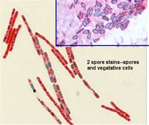 18 Spore Stain Biology Libretexts