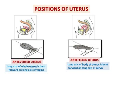 Ppt Anatomy Of The Female Reproductive System Powerpoint Presentation