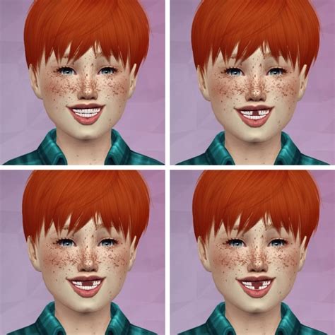 3d Realistic Teeth Child Version By Thiago Mitchell At